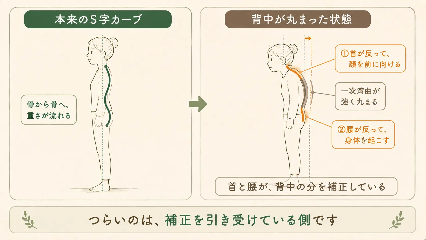 背中の丸まりを首と腰が補正している構造を示す図解